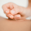 Acupuntura i fisioteràpia a domicili Barcelona