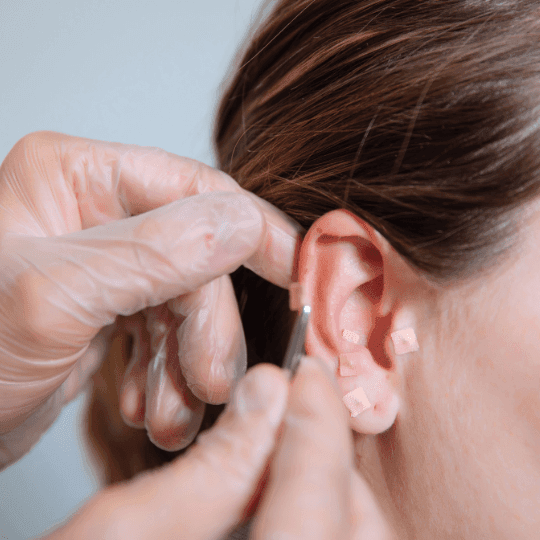Acupuntura i fisioteràpia a domicili Barcelona - Imatge 3